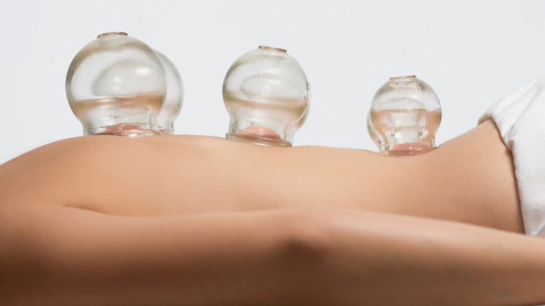 Curious About Cupping?, Marin Magazine