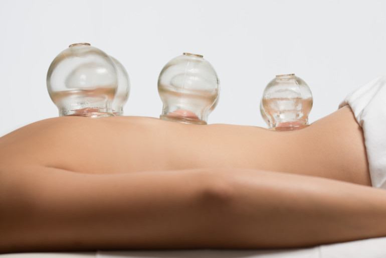 Curious About Cupping?, Marin Magazine